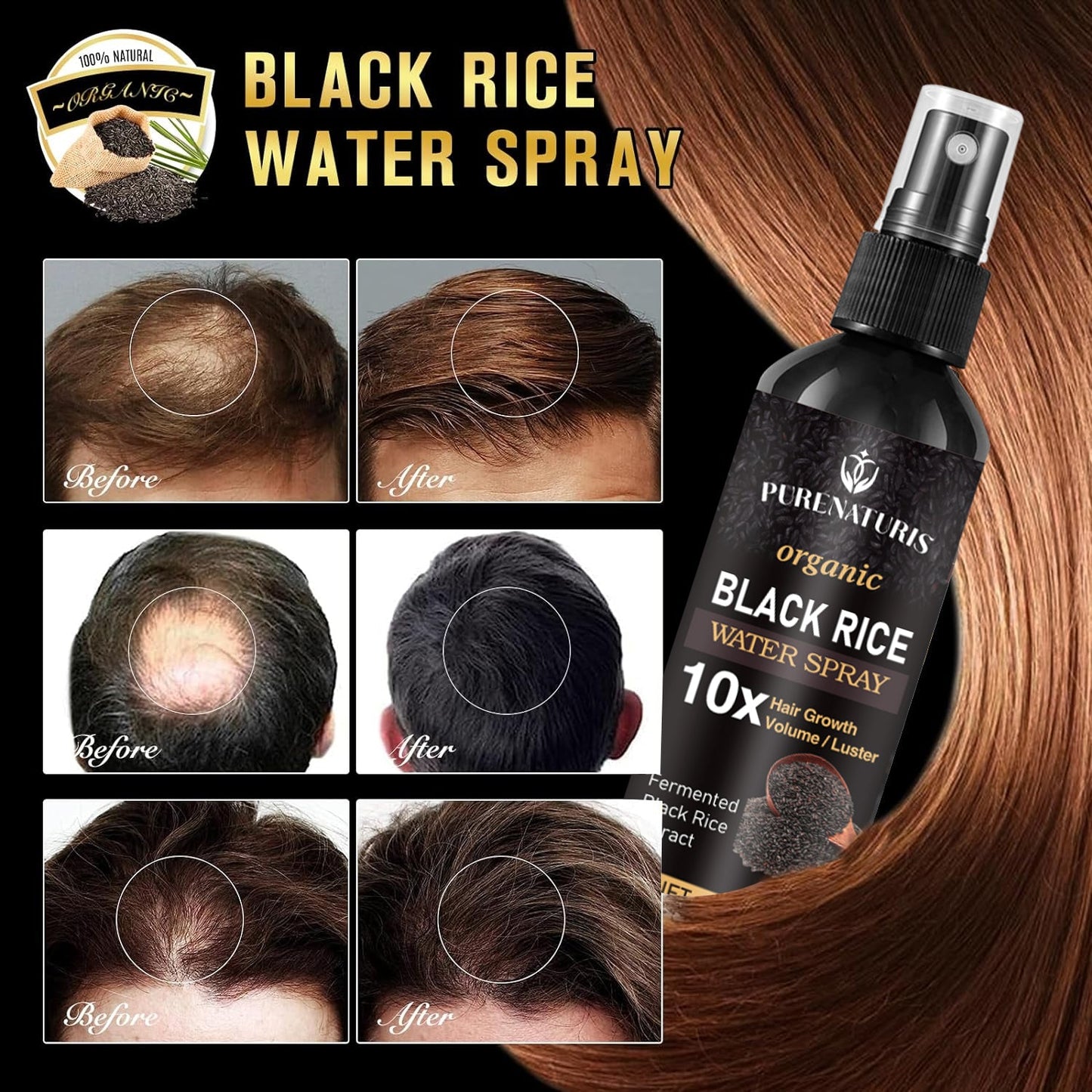 Natural Black Rice Water Hair Growth Spray For Women and Men  with Castor Oil Ginger